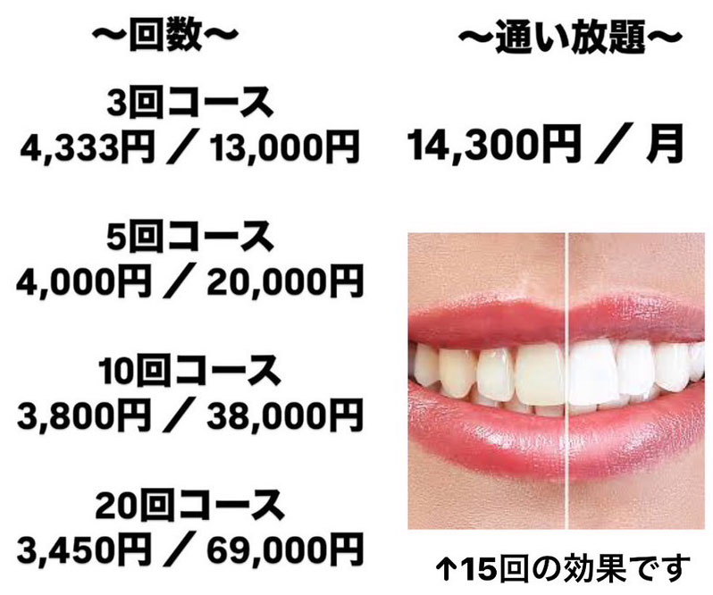ホワイトニングコース料金